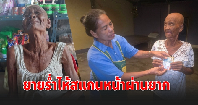 ยายป่วยมะเร็งโกนผม สแกนบัตรคนจนไม่ผ่านกว่า 20 ครั้ง ก่อนร้องไห้โฮเมื่อสำเร็จ