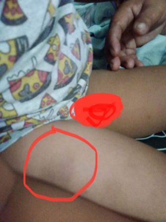 แอบดูขอดูหีหลาน 